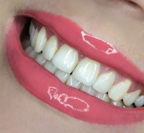 Naturalne sposoby na wybielanie zębów